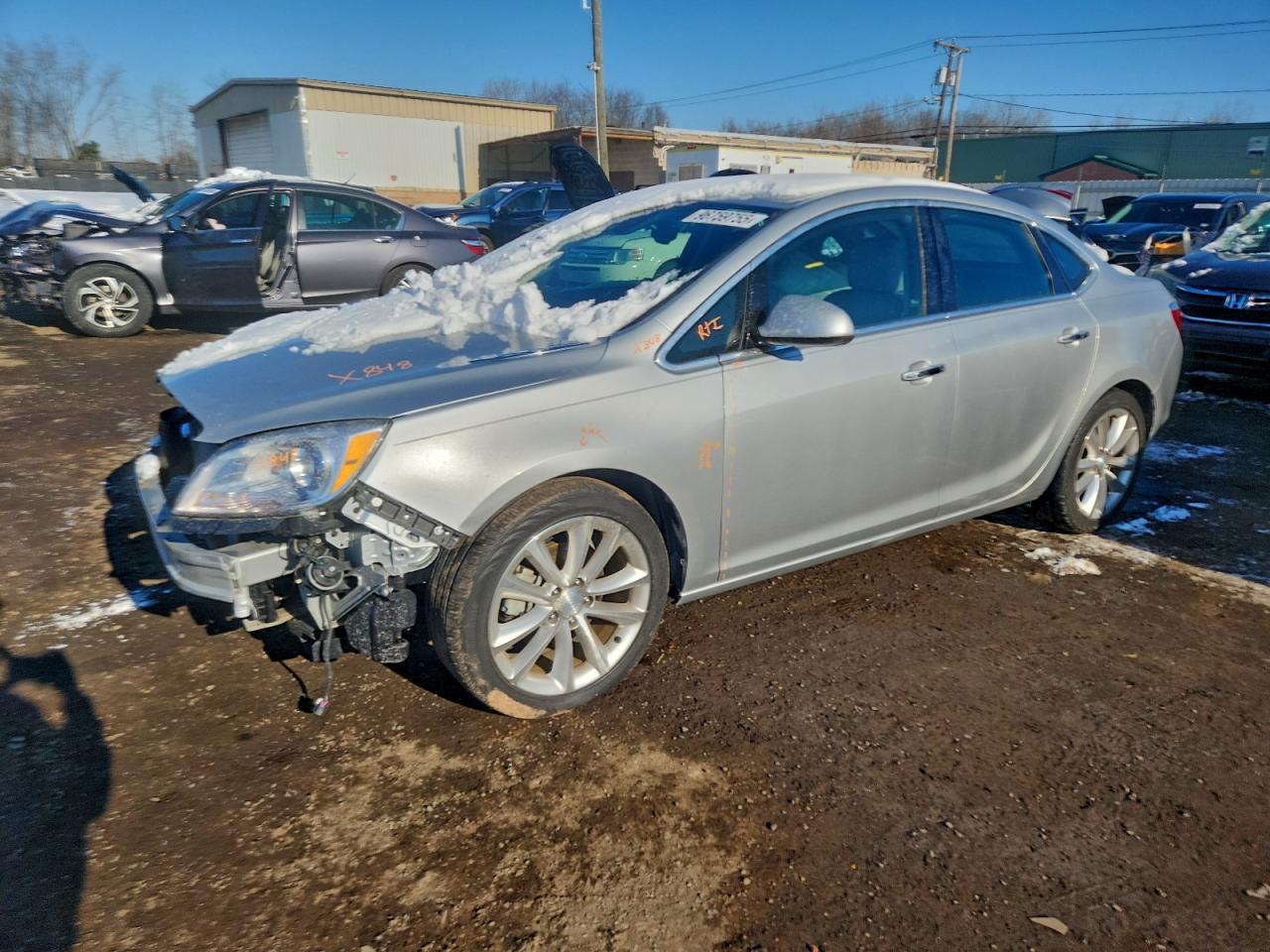 Buick Verano Convenience Image 1